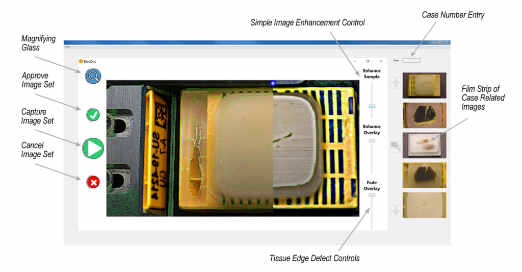 Annotated image pointing out highlights of the BlocDoc Software interface.