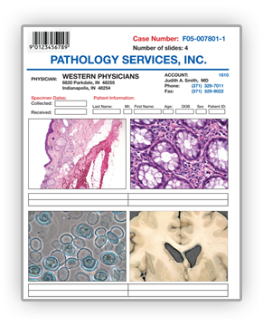 Pathology Report With Images