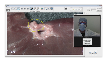 PathSuite Screen with Telepathology