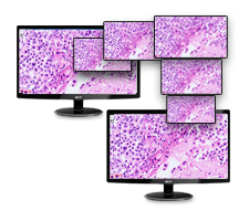 Telepathology Imaging Systems